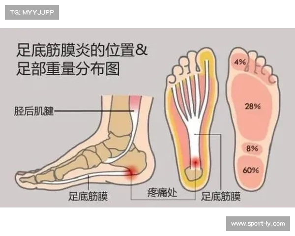 竞走运动损伤白皮书发布 足底筋膜炎成最常见问题 占比接近一半 竞走运动损伤白皮书发布 足底筋膜炎成最常见问题 占比接近一半